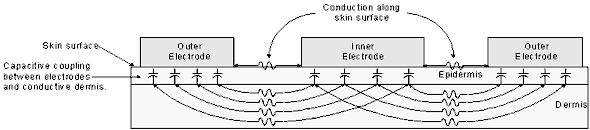 Fig. 2 A pair of concentric electrodes are in direct contact with the target area